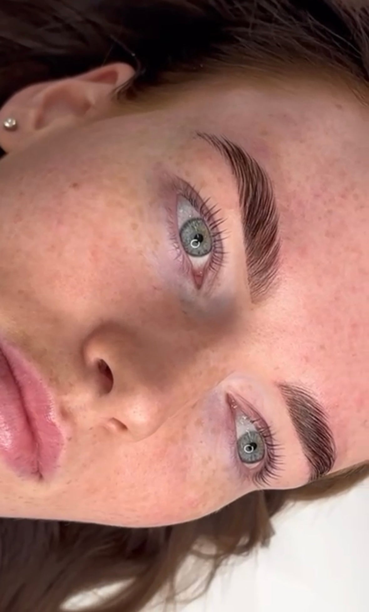 BROW LIFT TRAINING - ONLINE